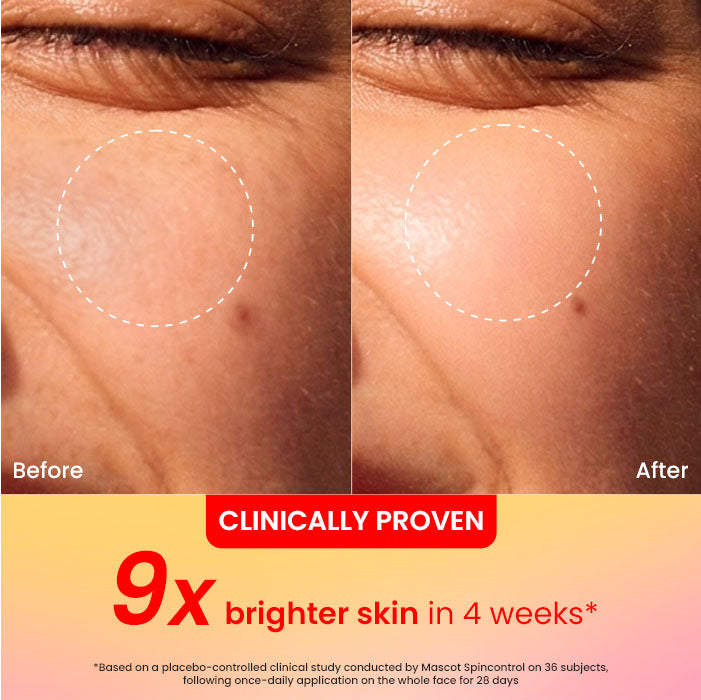 Vitamin C + E Super Bright Gel Moisturizer for Face - image 6